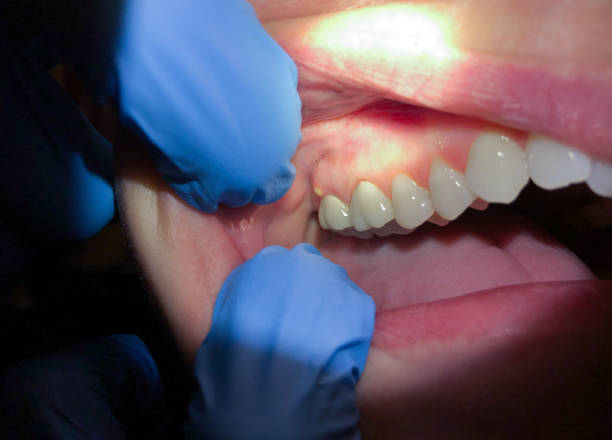 Best Emergency Dental Services for Seniors in Sterling, KS